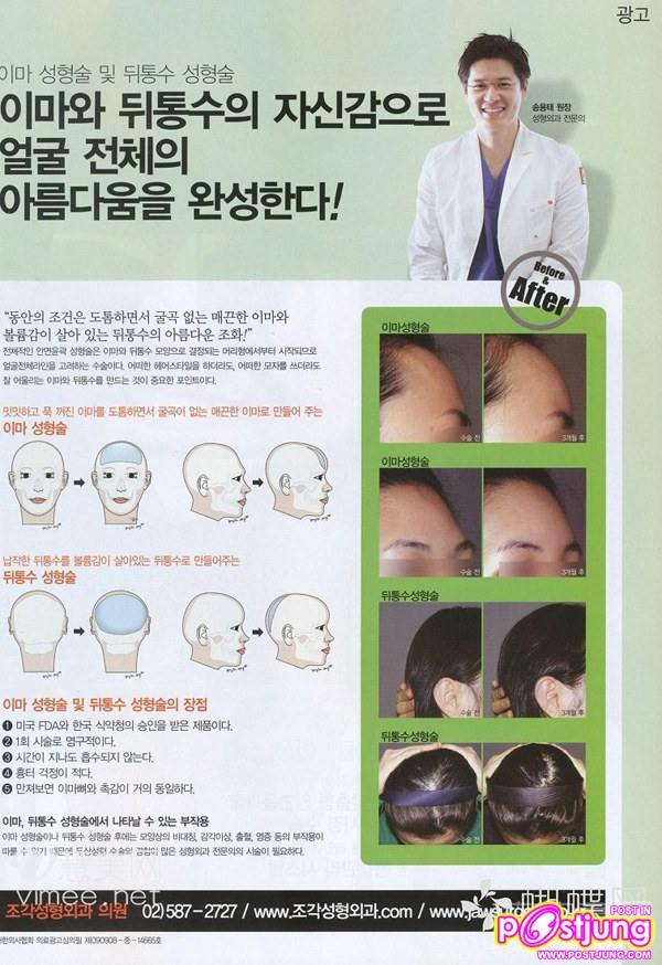 โฆษณาศัลยกรรมในเกาหลี