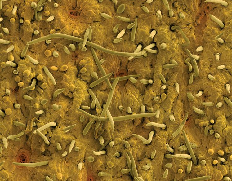 ภาพถ่าย เกสรและเมล็ดผลไม้ ด้วยกล้องจุลทรรศน์